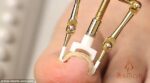 INGROWN TOOL - Image 3
