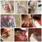 INGROWN TOOL - Image 2